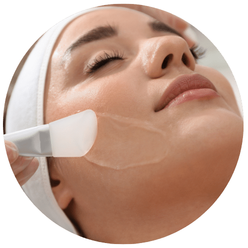 Chemical Peel