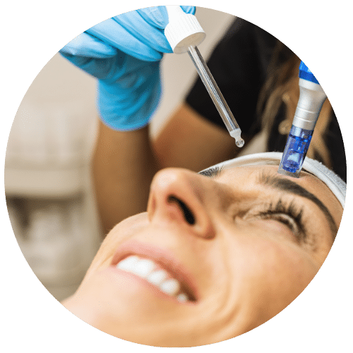 Matrix RF Microneedling (1)